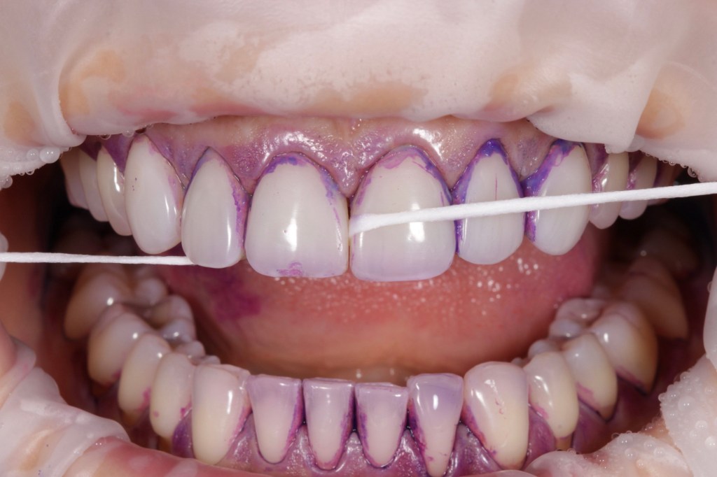Será que está a usar o fio dentário da forma correta?